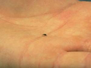 Hand with extremely small black insect. Insect is several millimeters long and has a distinctive, long, downward-curved mouthpart.