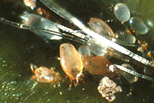 Microscope image showing tan-bodied cyclamen mites and transparent mite eggs.