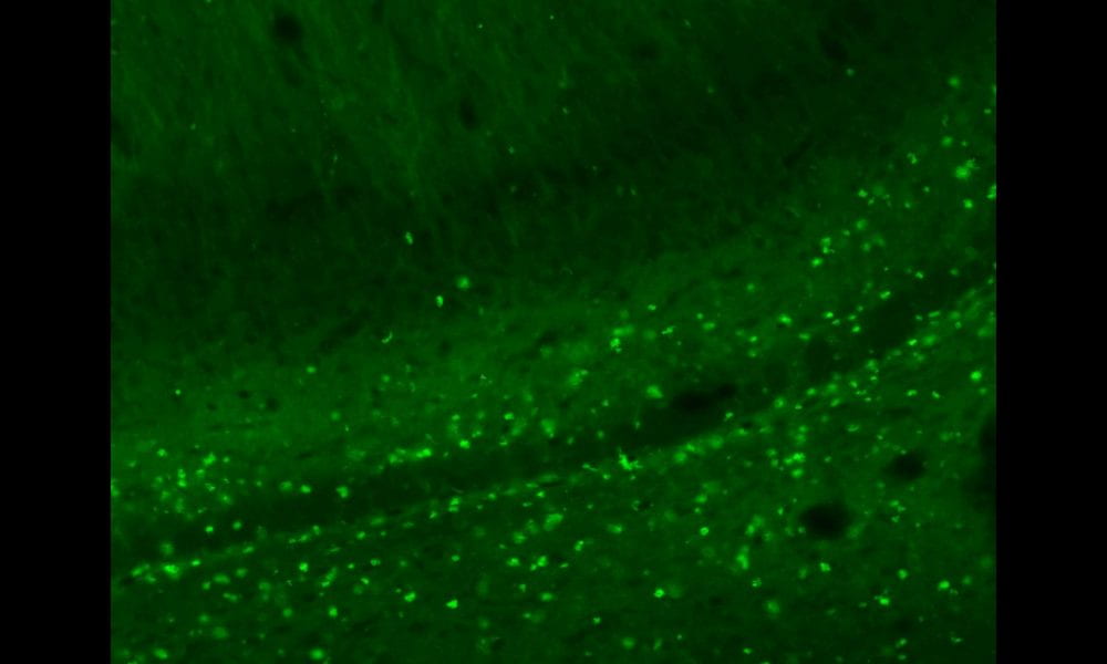 Green fluorescent photo showing channelrhodopsin expressed in ventral hippocampus.