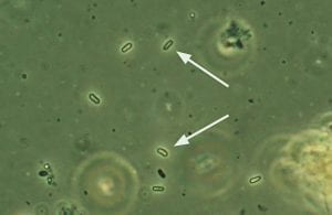 Nosema maddoxi spores at 400x under phase contrast.