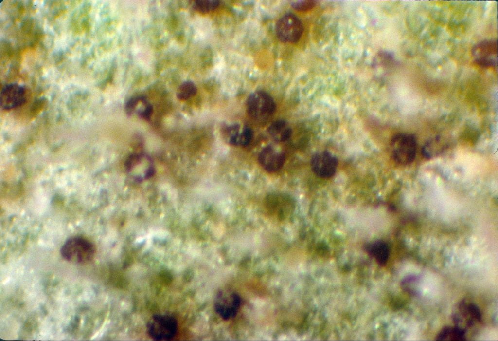powdery mildew chasmothecia under a microscope.