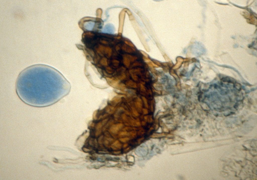 powdery mildew Chasmothecium under microscope.