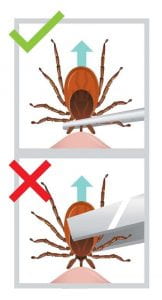 To safely remove a tick, use a point set of tweezers to grasp the tick as close to the skin a possible. Do NOT grab the back end of the tick.