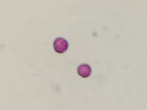 Viburnumopulus1
